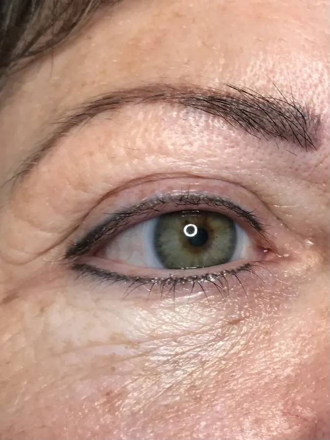 Wimpern vor dem Lifting